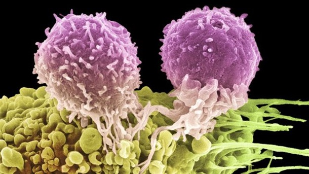 Т-лимфоциты, напавшие на раковую клетку. Медицинские новости, здоровье. МедЭксперт