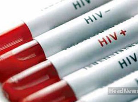 HIV ВИЧ. Медицинские новости, здоровье. МедЭксперт