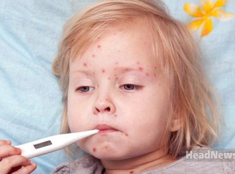 Корь. Медицинские новости, здоровье. МедЭксперт