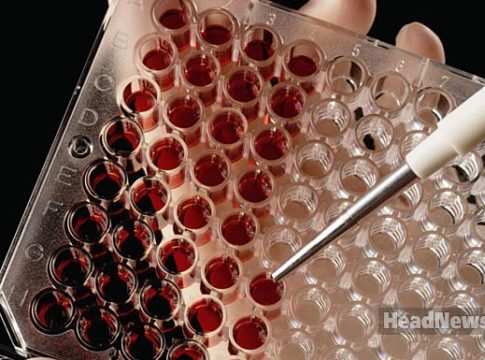 Медицинские пробы. Медицинские новости, здоровье. МедЭксперт